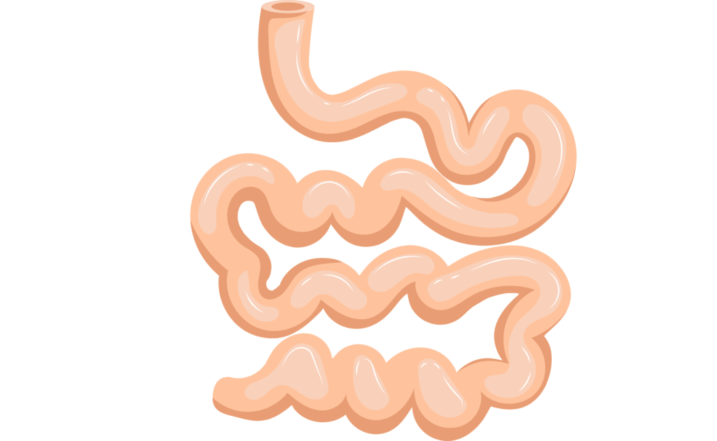 Dessin représentant l'intestin grêle. Cette image illustre l'hyper-perméabilité  intestinale qui doit être traitée dans le SIBO et l'IMO.