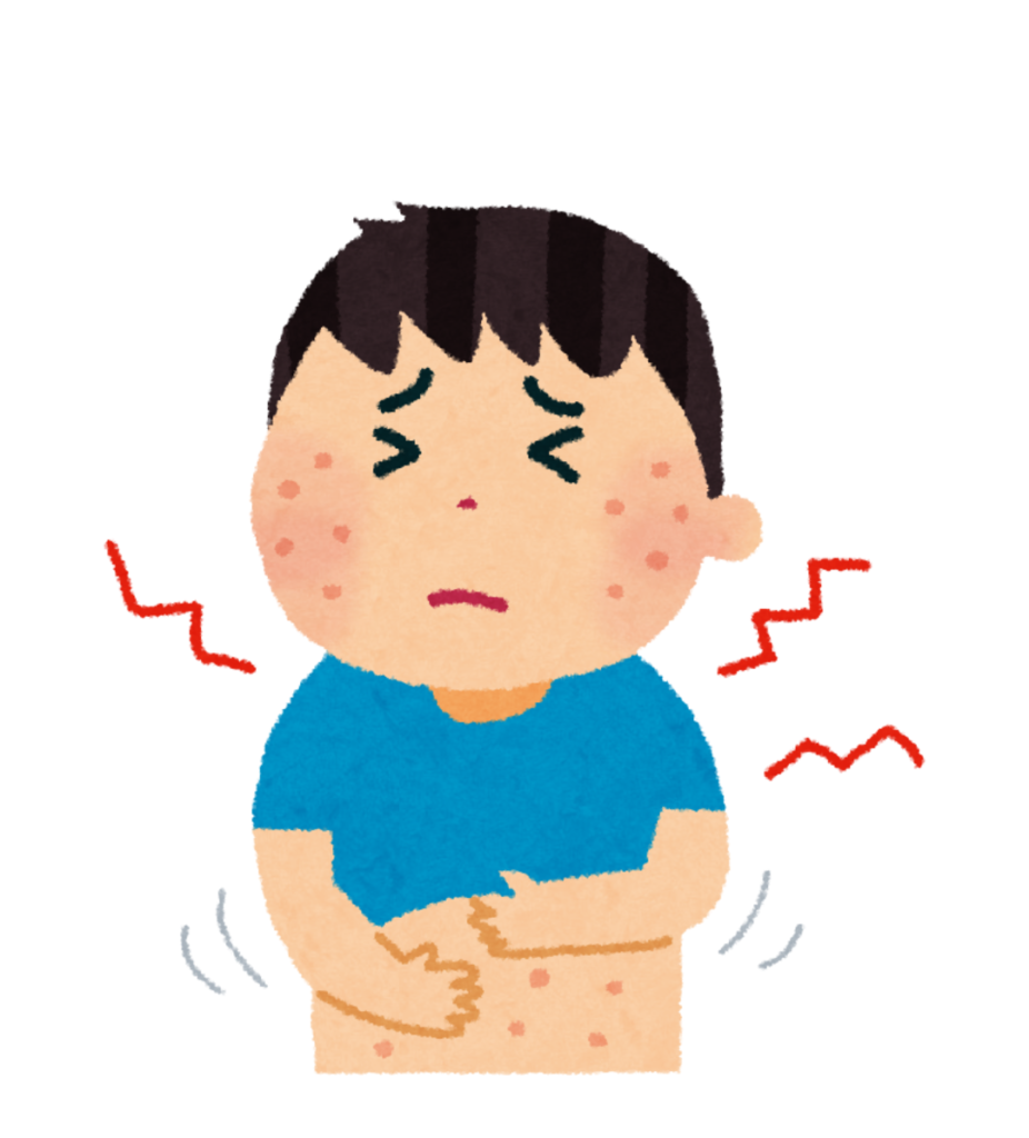 Dessin d'un personnage masculin se tenant le ventre de douleur et présentant des rougeurs sur le corps pour figurer l'allergie au blé. Dessin d'un point d’exclamation dans un triangle gris, lui même dans un cercle gris. Il illustre un point d'attention particulier, d'un article sur l’alimentation sans gluten, rédigé par Maud Guillemet, naturopathe à Besançon.